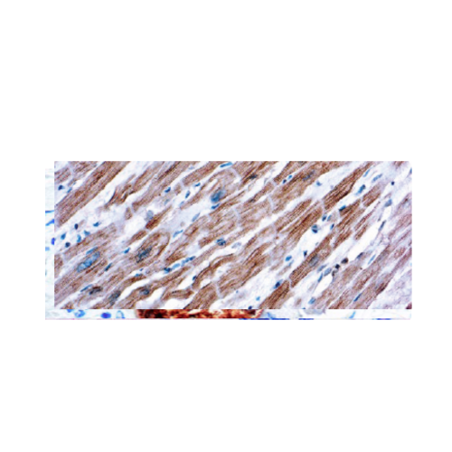 Actinin Actinin