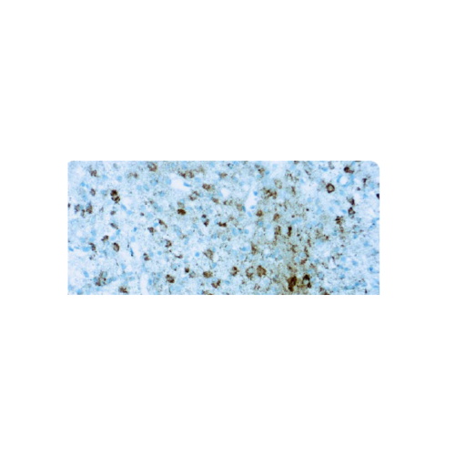 Anti-Isocitrate Dehydrogenase 1 Anti-Isocitrate Dehydrogenase 1