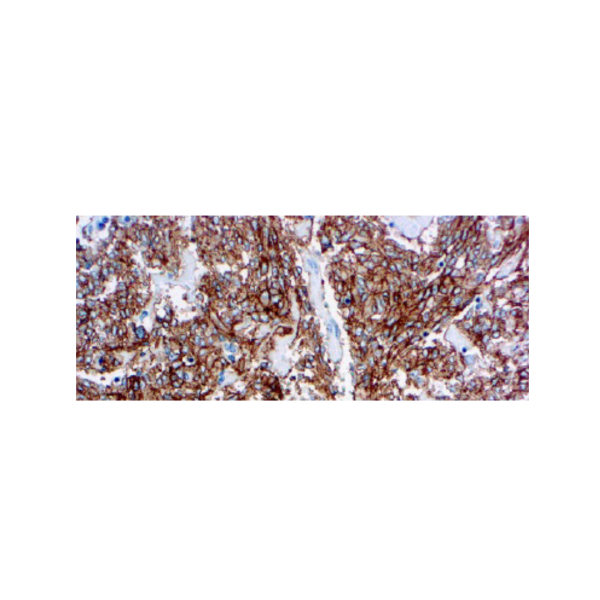CD117