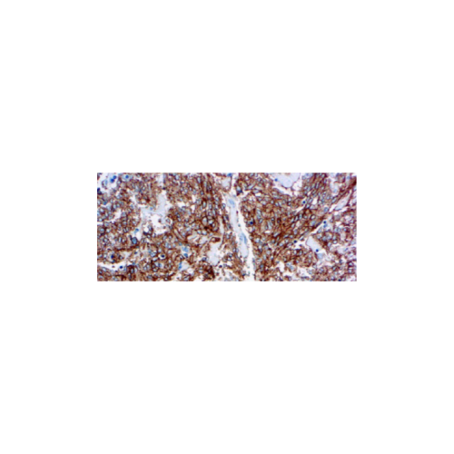 CD117 c-kit CD117 c-kit