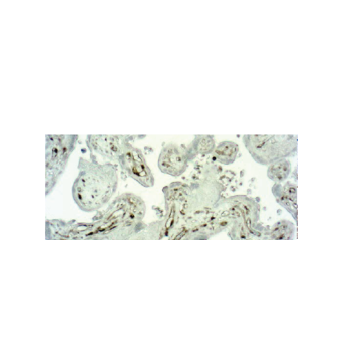 Caspase 1 Caspase 1