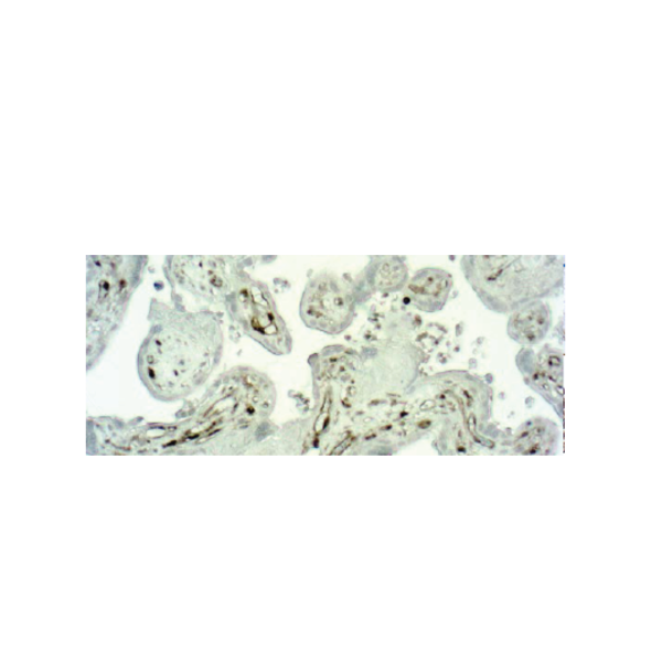 Caspase 1 Caspase 1