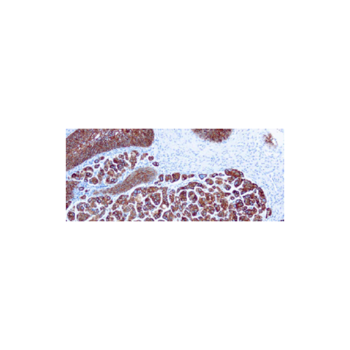 Citoqueratina 7 Citoqueratina 7