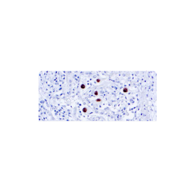 Cytomegalovirus Cytomegalovirus