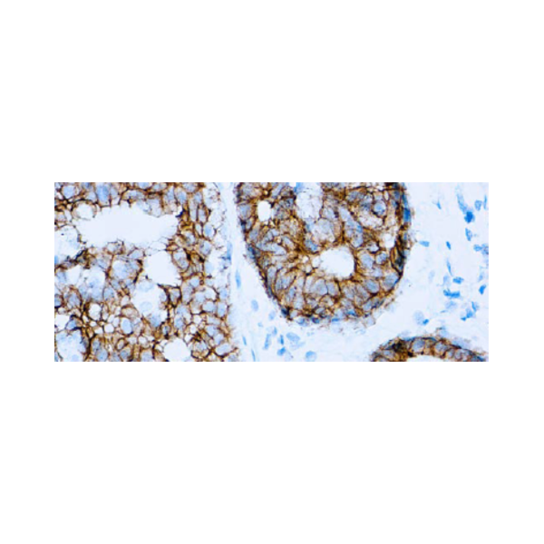 E-Cadherin E-Cadherin