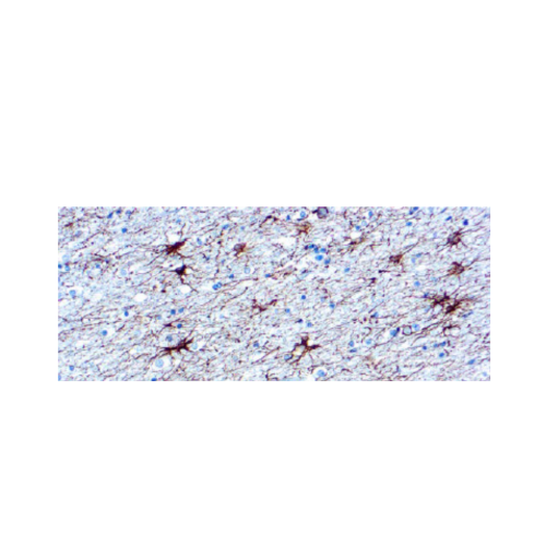 Glial Fibrillary Acidic Protein (GFAP) Glial Fibrillary Acidic Protein (GFAP)