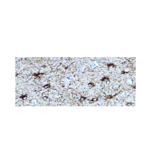 Glial Fibrillary Acidic Protein (GFAP) Anticuerpo monoclonal de Conejo Glial Fibrillary Acidic Protein (GFAP) Anticuerpo monoclonal de Conejo
