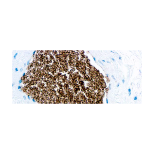 Glicoforina C Glicoforina C