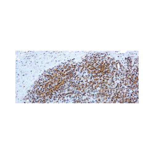 Glypican-3 Glypican-3