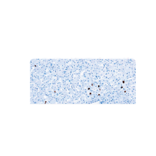 Hepatitis B Surface Antigen