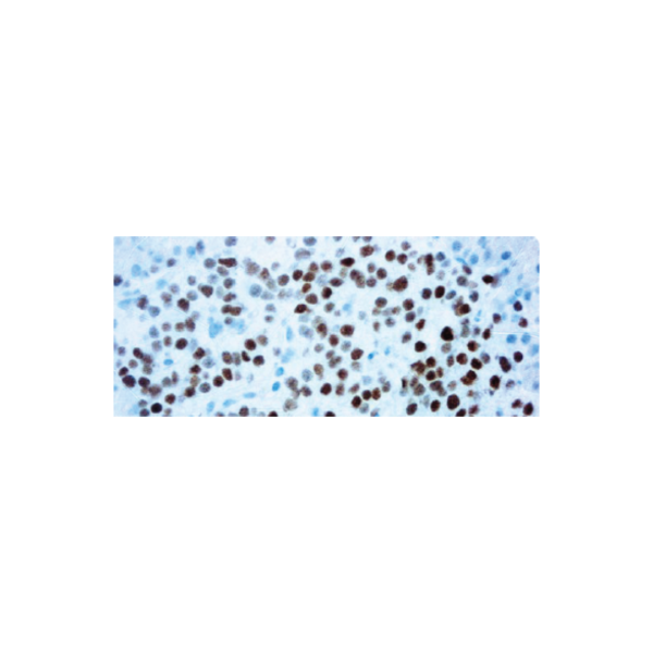 INSM1 (A-8)