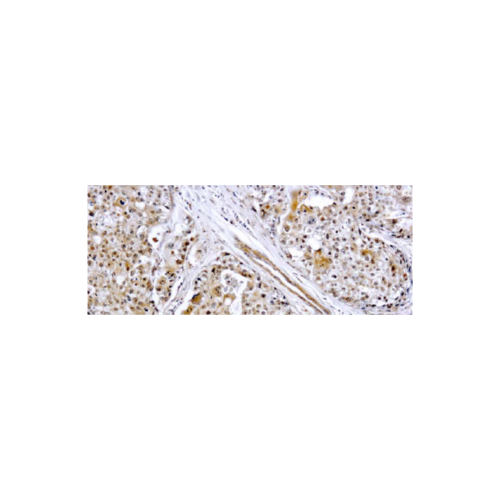 MMP-9 MMP-9