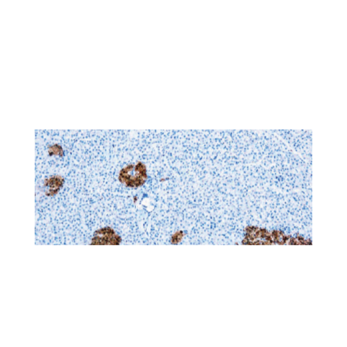 Neuron Specific Enolase Neuron Specific Enolase