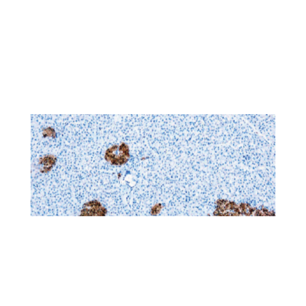 Neuron Specific Enolase