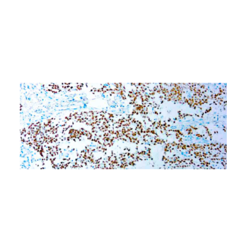 SALL4 (6E3)