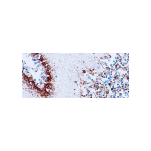 Tau (Neurofibrillary Tangles Marker) Tau (Neurofibrillary Tangles Marker)