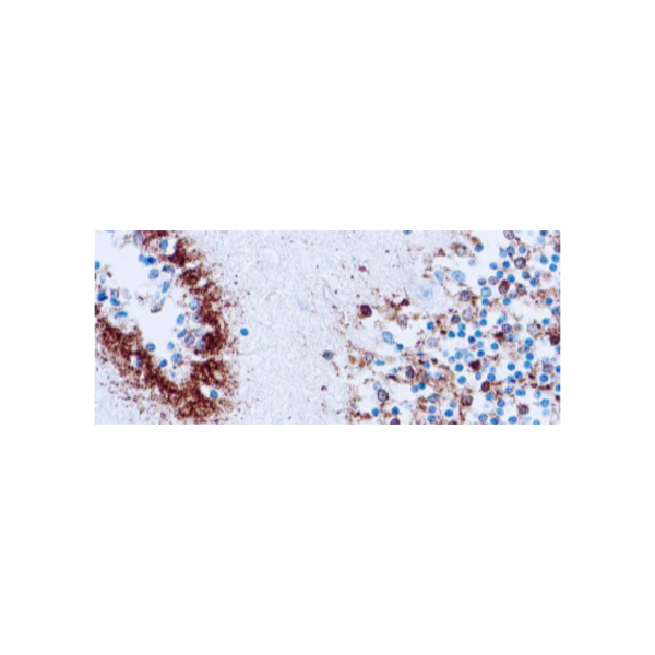 Tau (Neurofibrillary Tangles Marker)
