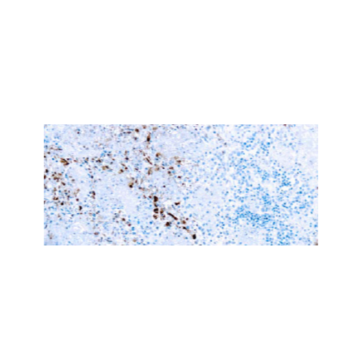 Virus del Herpes Simplex Tipo I