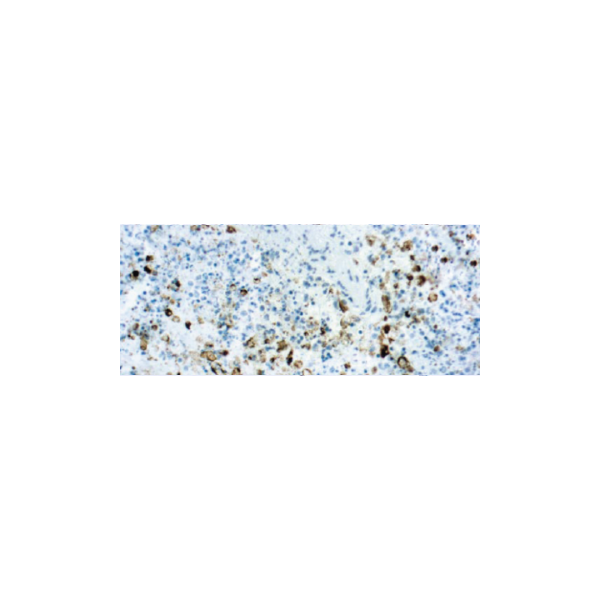 Virus del Herpes Simplex Tipo II (HSV2) Virus del Herpes Simplex Tipo II (HSV2)