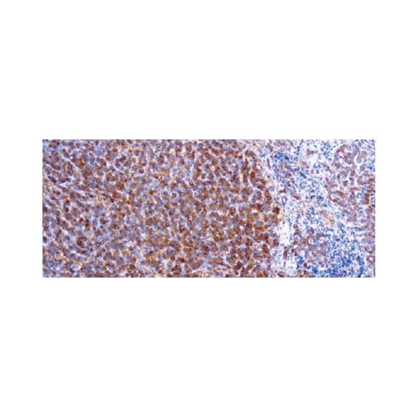 α-1-Antitrypsin α-1-Antitrypsin