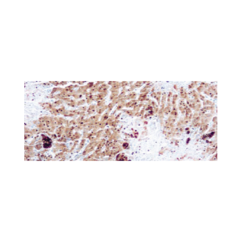 α Fetoprotein (AFP) α Fetoprotein (AFP)