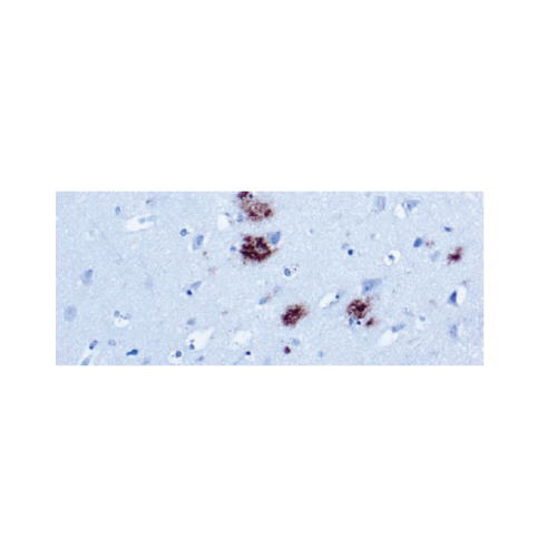 β-Amyloid Protein β-Amyloid Protein