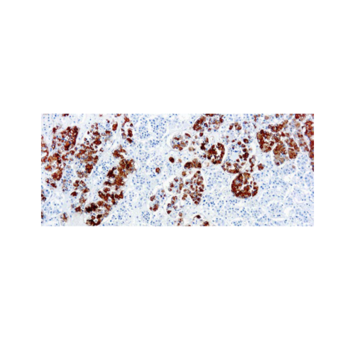 Adrenor Ticotropic Hormona Adrenor Ticotropic Hormona