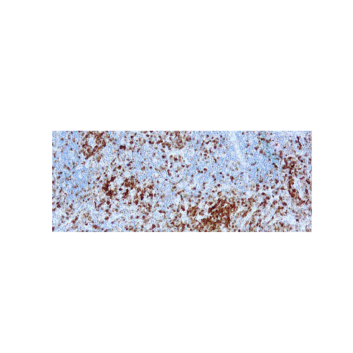 Anaplastic Lymphoma Kinase p80 Anaplastic Lymphoma Kinase p80