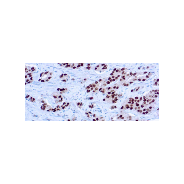 Androgen Receptor Androgen Receptor