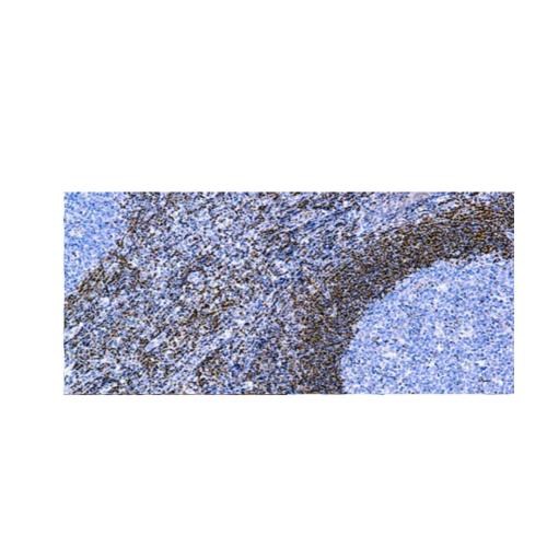 Bcl-2 Onco Proteina Bcl-2 Onco Proteina