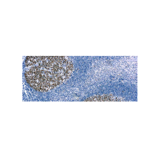 Bcl-6 (PG-B6) Bcl-6 (PG-B6)
