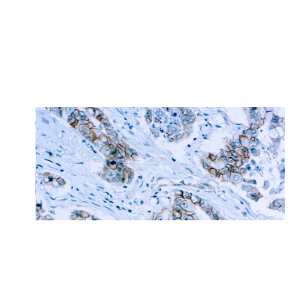 Beta-Catenin Beta-Catenin
