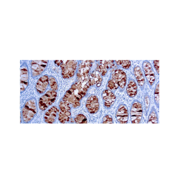 CA 19-9 CA 19-9