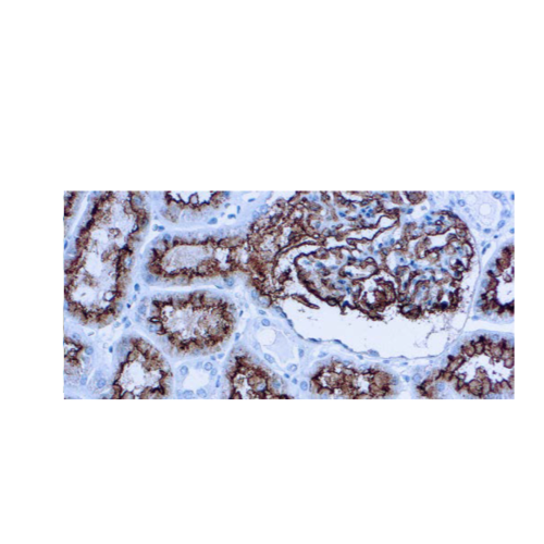 CD10 (CALLA) CD10 (CALLA)