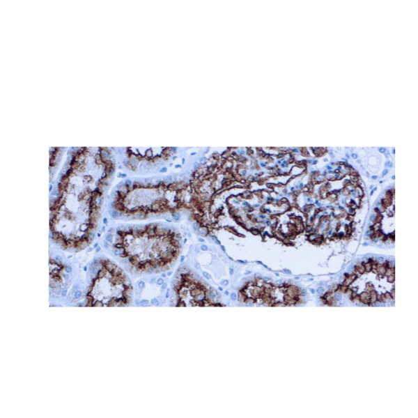 CD10 (CALLA) CD10 (CALLA)