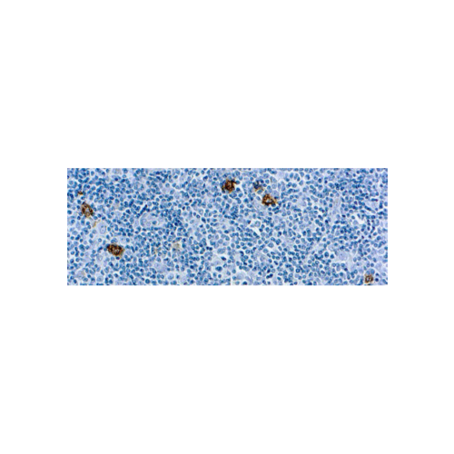 CD15Reed-Sternberg Cell Marker CD15Reed-Sternberg Cell Marker