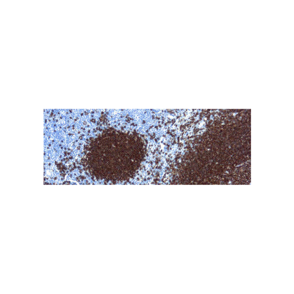 CD20, B-cell (L26) CD20, B-cell (L26)