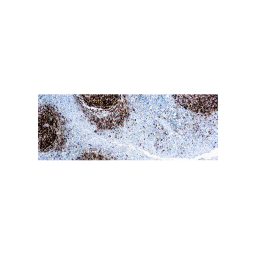 CD23 (1 B12) CD23 (1 B12)