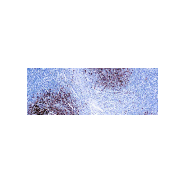 CD23 (SP23) CD23 (SP23)