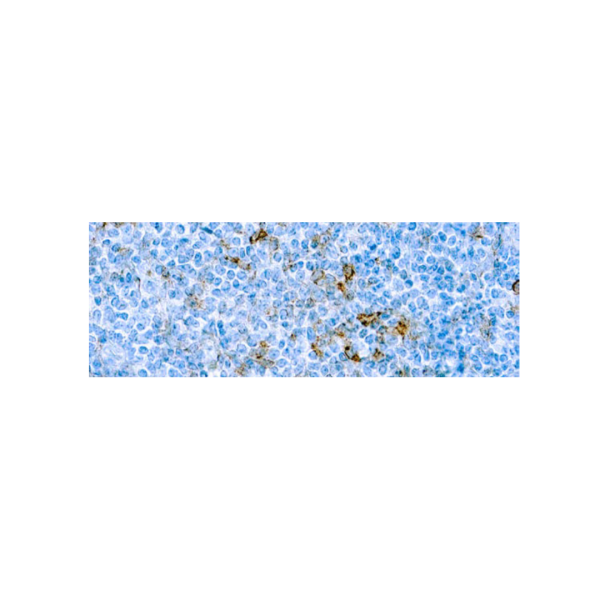 CD25IL‐2R α CD25IL‐2R α