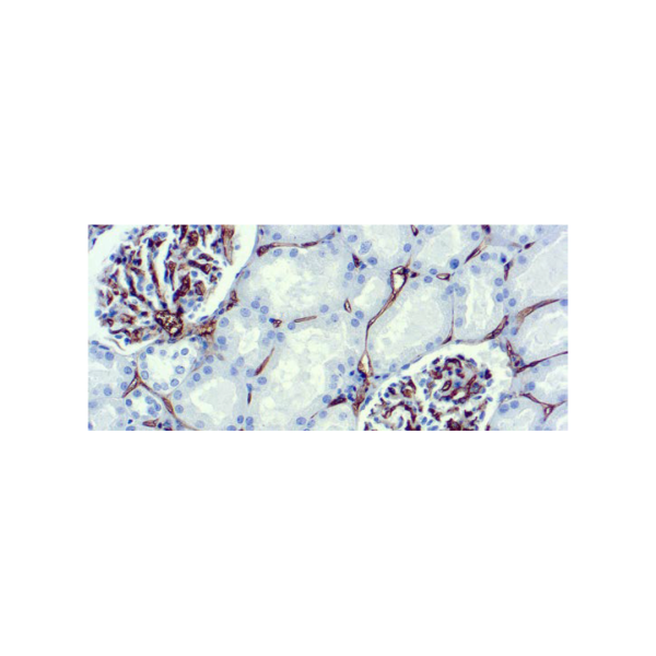 CD34, Célula Endotelial CD34, Célula Endotelial