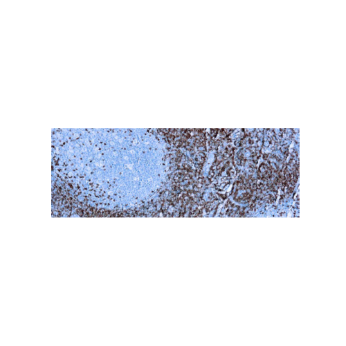 CD5 (SP19) CD5 (SP19)