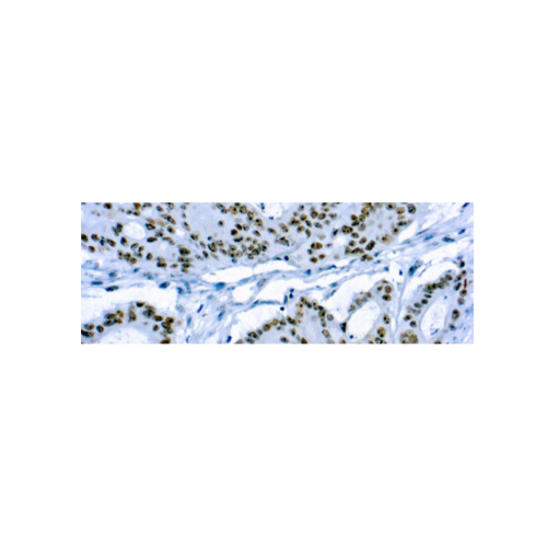 CD56Neural Cell Adhesion Molecule-1