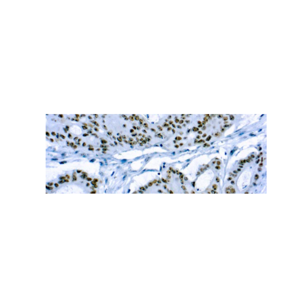 CD56Neural Cell Adhesion Molecule-1 CD56Neural Cell Adhesion Molecule-1