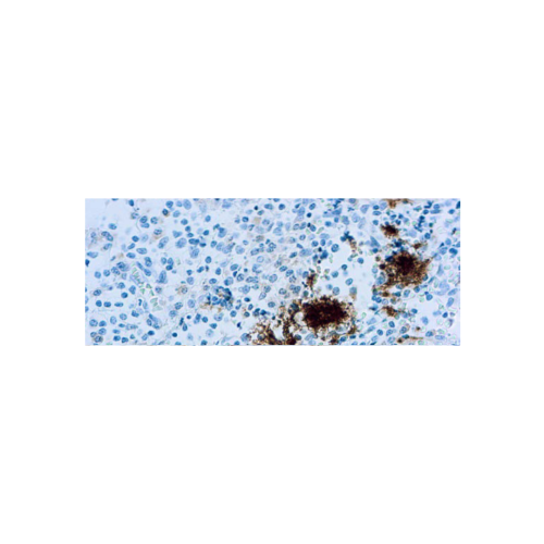 CD61Glycoprotein IIIa plaquetas CD61Glycoprotein IIIa plaquetas