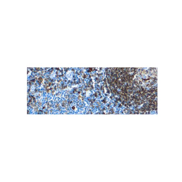 CD74, Marcador de linfoides CD74, Marcador de linfoides