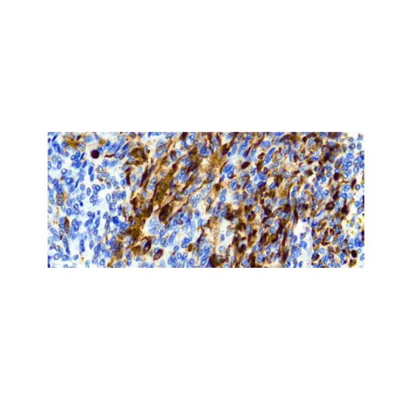 Calretinin (H-5) Calretinin (H-5)