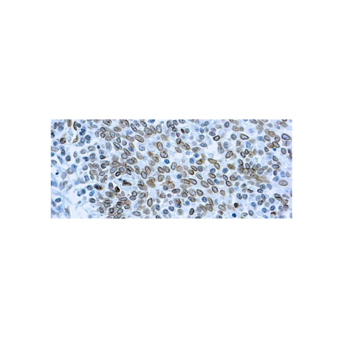 Cdc25A Cdc25A