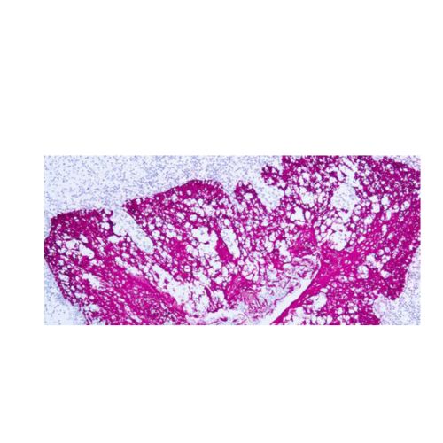 Citoqueratina, alto peso molecular Citoqueratina, alto peso molecular