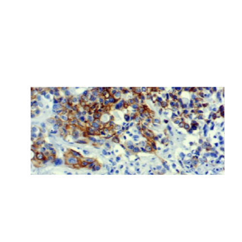 Cytokeratin 7